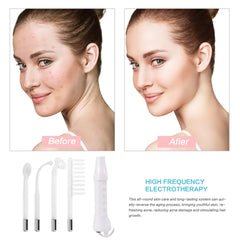 Anti-Wrinkle Skin Therapy 4-in-1 Wand